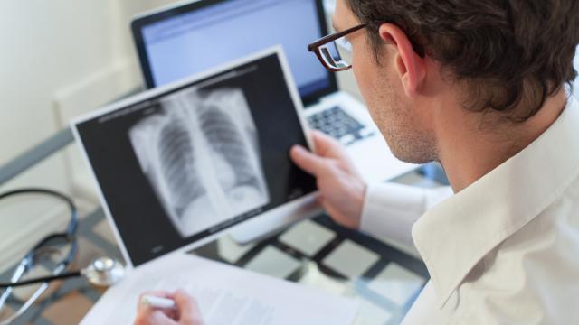 A medical professional viewing x-rays of a chest.