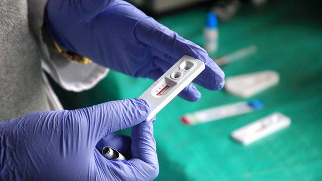 Testing for HIV using a medical device.