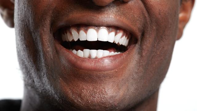 Close-up of teeth.