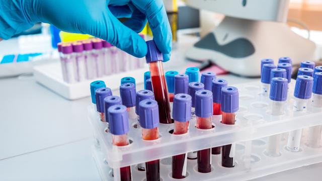 Blue gloved hand add a vial of blood to a tray