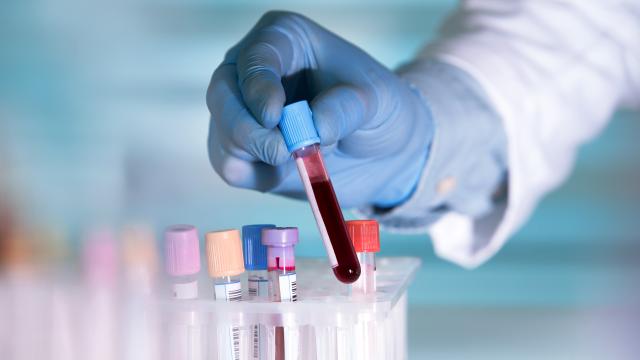 Lab tech holding a blood sample with a tray of vials