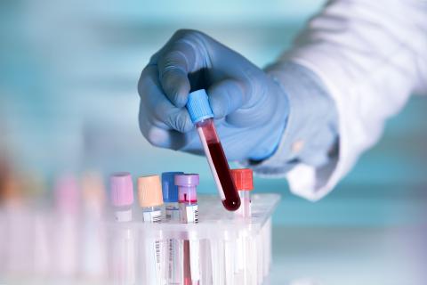 Lab tech holding a blood sample with a tray of vials