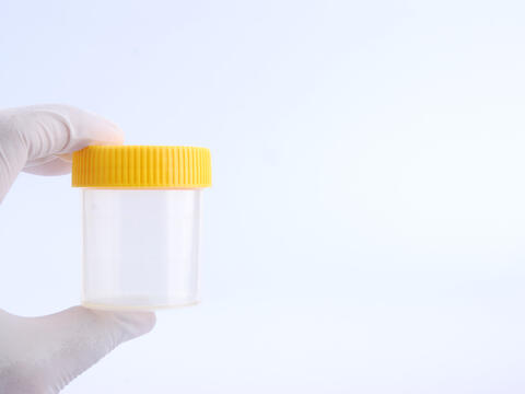 Adult gloved hand holds a urine test container
