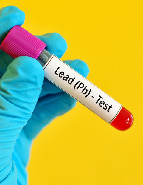 Gloved hand holding blood sample in a test tube for a lead test