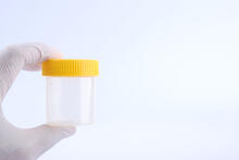 Adult gloved hand holds a urine test container